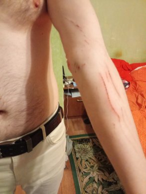 1) Следы побоев на теле мужа Надежды Беловой / Фото: Надежда Белова, «Слово защите»