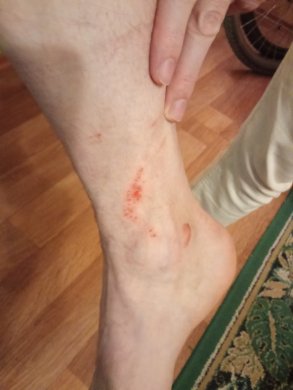 2) Следы побоев на теле мужа Надежды Беловой / Фото: Надежда Белова, «Слово защите»